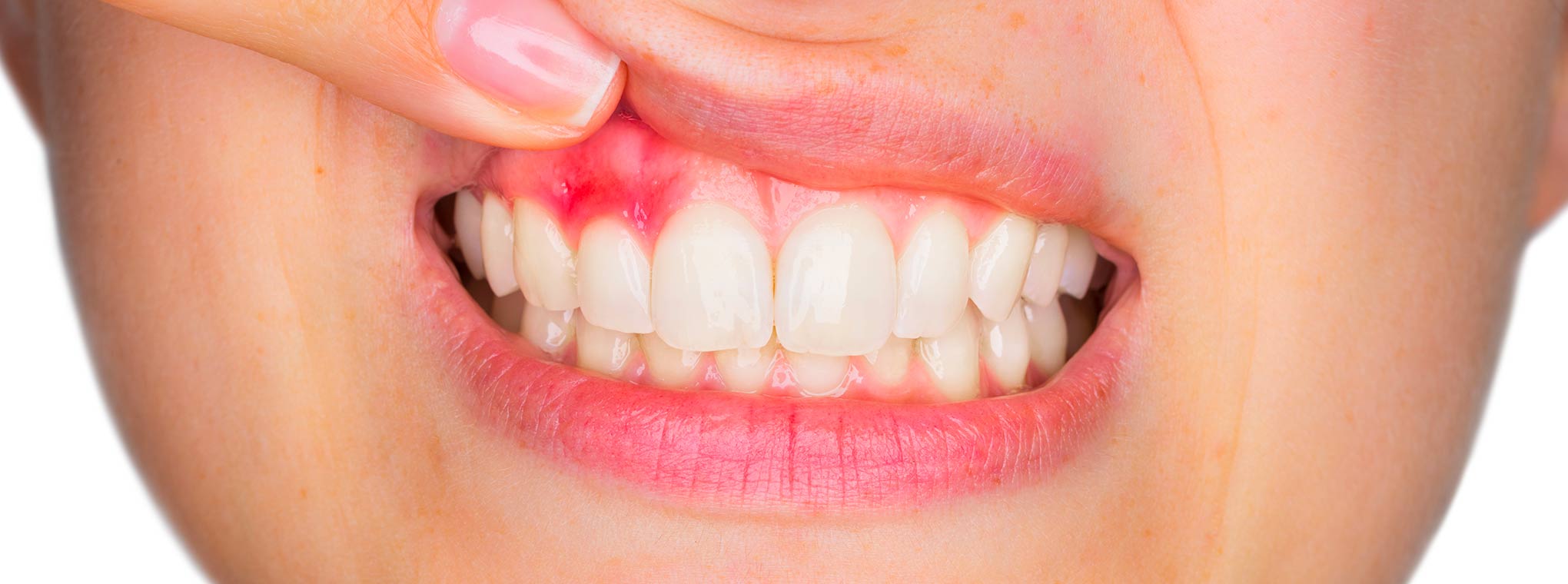 Garda Odontoiatria | Parodontologia